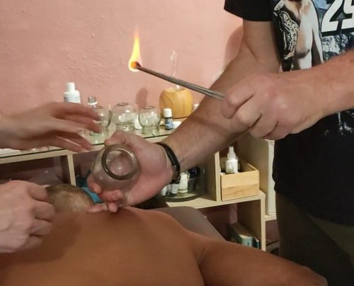 formation ventouses hijama
